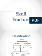 Skull Fracture