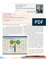 Belin Ambrosio Enhanced Ectasia Detection