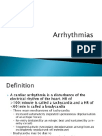 Arrhythmias