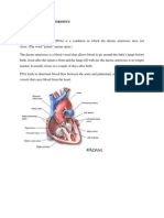 Patent Ductus Arteriosus