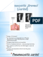 Pneumocystis Jiroveci