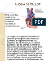 Tetralogia de Fallot