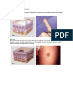 Lesiones Primarias en Cavidad Bucal