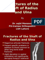 Fractures of The Shaft of Radius and Ulna