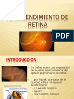 Desprendimiento de Retina