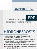 HIDRONEFROSIS