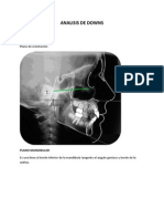 Analisis de Downs