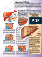 Cirrosis Hepatica