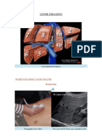 Liver Imaging