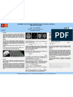 Automatic Detection and Segmentation of Cortical Lesions in Multiple Sclerosis