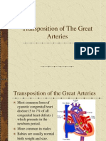 Transposition of The Great Arteries