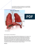 Case Study Pleural Effusion