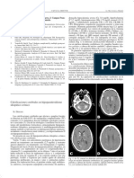 Calcificaciones Cerebrales e Hipotiroidismo