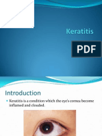 Keratitis