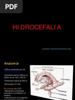 Hidrocefalia Expo