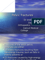 Pelvic Fractures