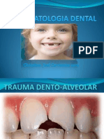 Trauma Alveolo Dental