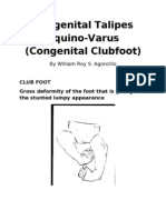 Congenital Talipes Equino-Varus (Congenital Clubfoot) : by William Roy S. Agoncillo