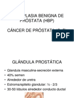 Tumor Es Prostata