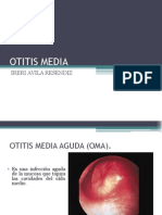 Otitis Media