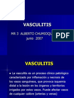 Vasculitis Bien