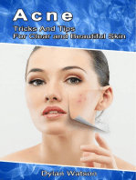 Acne: Tricks And Tips For Clear and Beautiful Skin