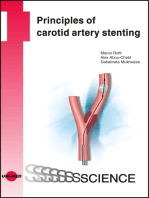 Principles of carotid artery stenting