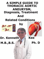 A Simple Guide to Thoracic Aortic Aneurysm, Diagnosis, Treatment and Related Conditions