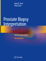 Prostate Biopsy Interpretation: An Illustrated Guide