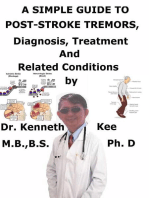 A Simple Guide to Post-stroke Tremors, Diagnosis, Treatment and Related Conditions