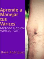 Aprende a Manejar tus Várices Método Natural Várices _Off_