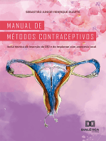 Manual de métodos contraceptivos: inclui técnica de inserção do DIU e do Implanon com anestesia local