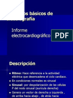 Clase 2 Informe de ECG