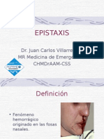 Epistaxis