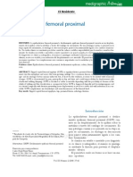 Epifisiolistesis Femoral Proximal