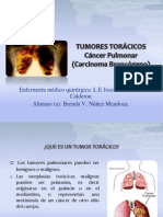 Cancer Pulmonar