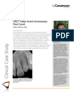 Carestream - Cohenca Endo Clinical Case - August 2012