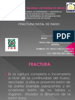 Exposicion Fractura de Radio