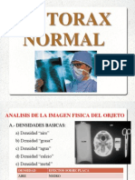 RX Torax Normal y Patologica