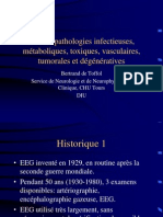 EEG Et Pathologies Infectieuses, Métaboliques, Toxiques, Vasculaires, Tumorales Et Dégénératives DIUdécembre09