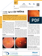 The Spotty Retina