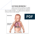 Atelectasia Neonatal - GEMA Y JOHANA