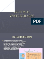 ARRITMIAS VENTRICULARESCorregida