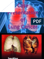 Presentation Lung Cancer Latest