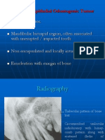 Odontogenic Tumours - (2) L5