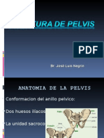 Fractura de Pelvis.. BR Jose Luis Negrin