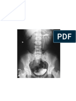 Pediatric Surgery X Rays