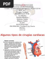 Cirugias Cardiacas