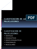 Clasificacion de Maloclusiones