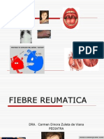 Fiebre Reumatica